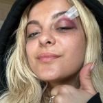 Bebe Rexha'S Concert: A Fan'S 'Funny' Act Turns Into A Serious Safety Concern, Yours Truly, Reviews, February 25, 2024