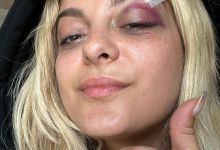 Bebe Rexha'S Concert: A Fan'S 'Funny' Act Turns Into A Serious Safety Concern, Yours Truly, News, April 27, 2024