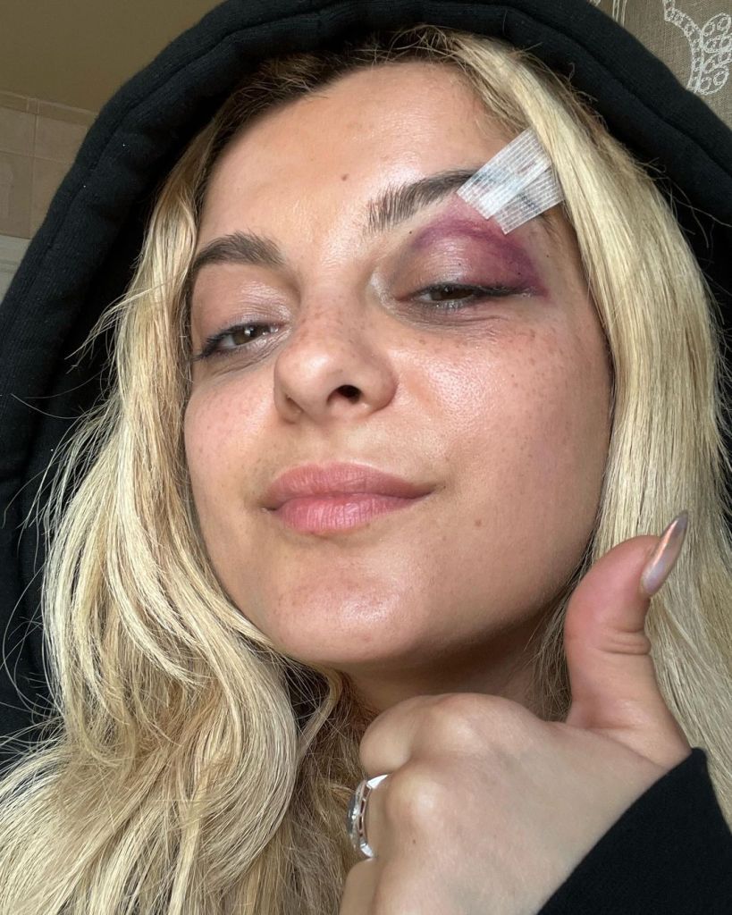 Bebe Rexha Remains Defiant Against Body-Shamers; Says “I Know I Got Fat”, Yours Truly, News, May 12, 2024