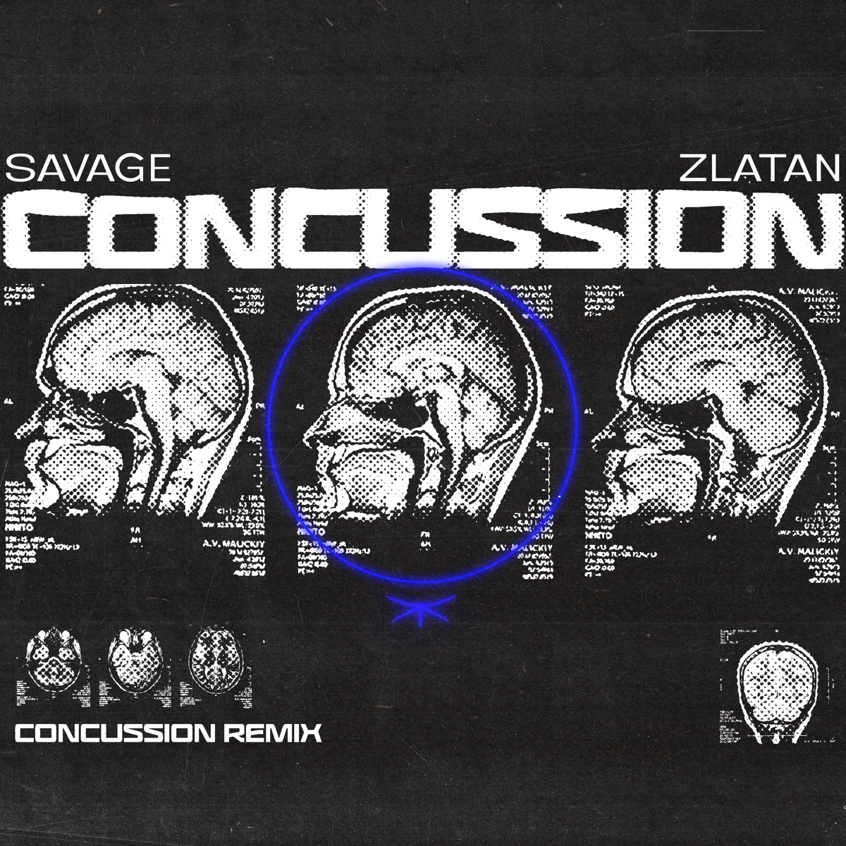 Savage &Amp; Zlatan - Concussion (Remix), Yours Truly, Music, May 3, 2024